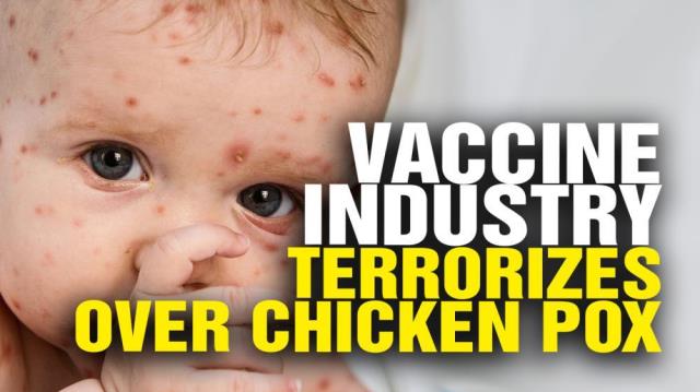 Vaccine industry TERRORIZES families over CHICKEN POX!