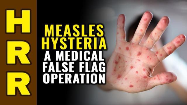 Measles HYSTERIA a medical false flag operation